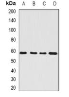 SARS / Serine-tRNA Ligase Antibody