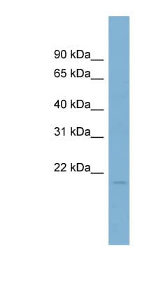 CLP / COTL1 Antibody (N-Terminus)