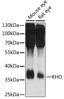 Rhodopsin / RHO Antibody