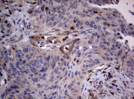 Hamartin / TSC1 Antibody (clone OTI5A8)
