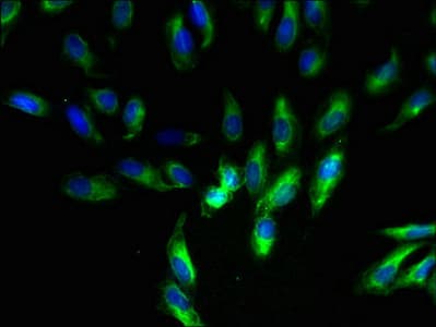 UQCR11 / UQCR Antibody
