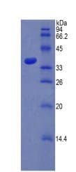 Rat SULT1A1 / Sulfotransferase 1A1 Protein (Recombinant His, N-Terminal)