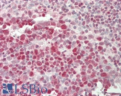 IHC-plus™ PHF6 Antibody (aa125-175)
