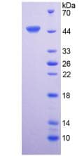 Human IL6 / Interleukin 6 Protein (Recombinant His-GST, N-terminus)