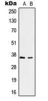 Polyclonal Rabbit anti-Human RNF113B Antibody (Internal, WB)