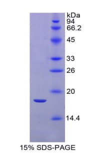 Rat TNFSF13 / APRIL Protein (Recombinant His)