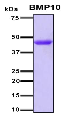 Human BMP10 Protein (Recombinant 6His, N-terminus)