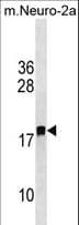LDOC1L Antibody (aa160-186)