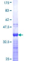 Human CDX1 Protein (Recombinant GST, N-terminus)