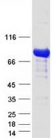 Human EPS8L2 Protein (Recombinant Myc-DDK (Flag))