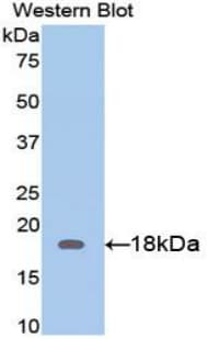 FLG2 Antibody (aa1222-1368)