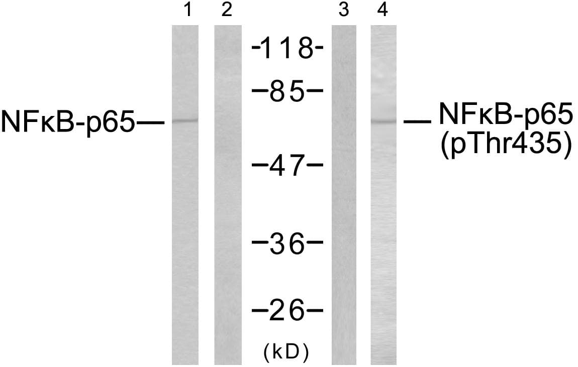 Polyclonal Rabbit anti-Human RELA / NFKB p65 Antibody (phospho-Thr435, IHC, WB)