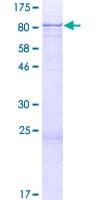 Human ZNF354A Protein (Recombinant GST)