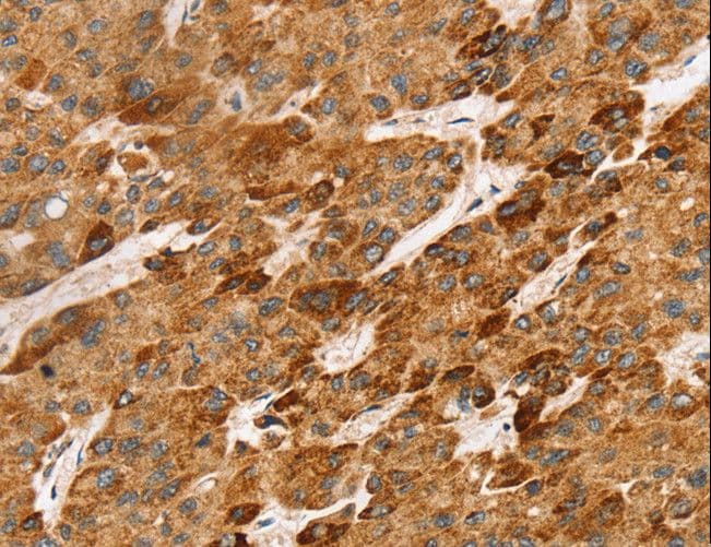 Polyclonal Rabbit anti-Human Lymphotoxin-Beta / LTB Antibody (IHC)
