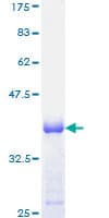 Human IFI16 Protein (Recombinant GST, N-terminus)