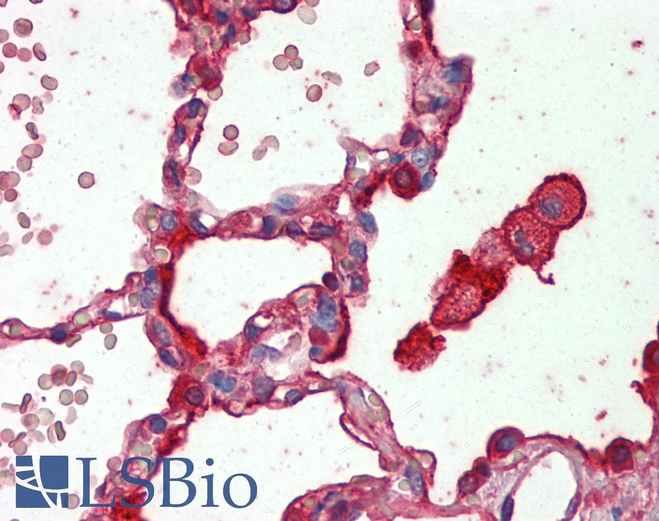 IHC-plus™ SFTPA1 / Surfactant Protein A Antibody