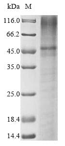 Human KCNK3 / OAT1 Protein (Recombinant 10His, N-terminus + Myc, C-terminus)