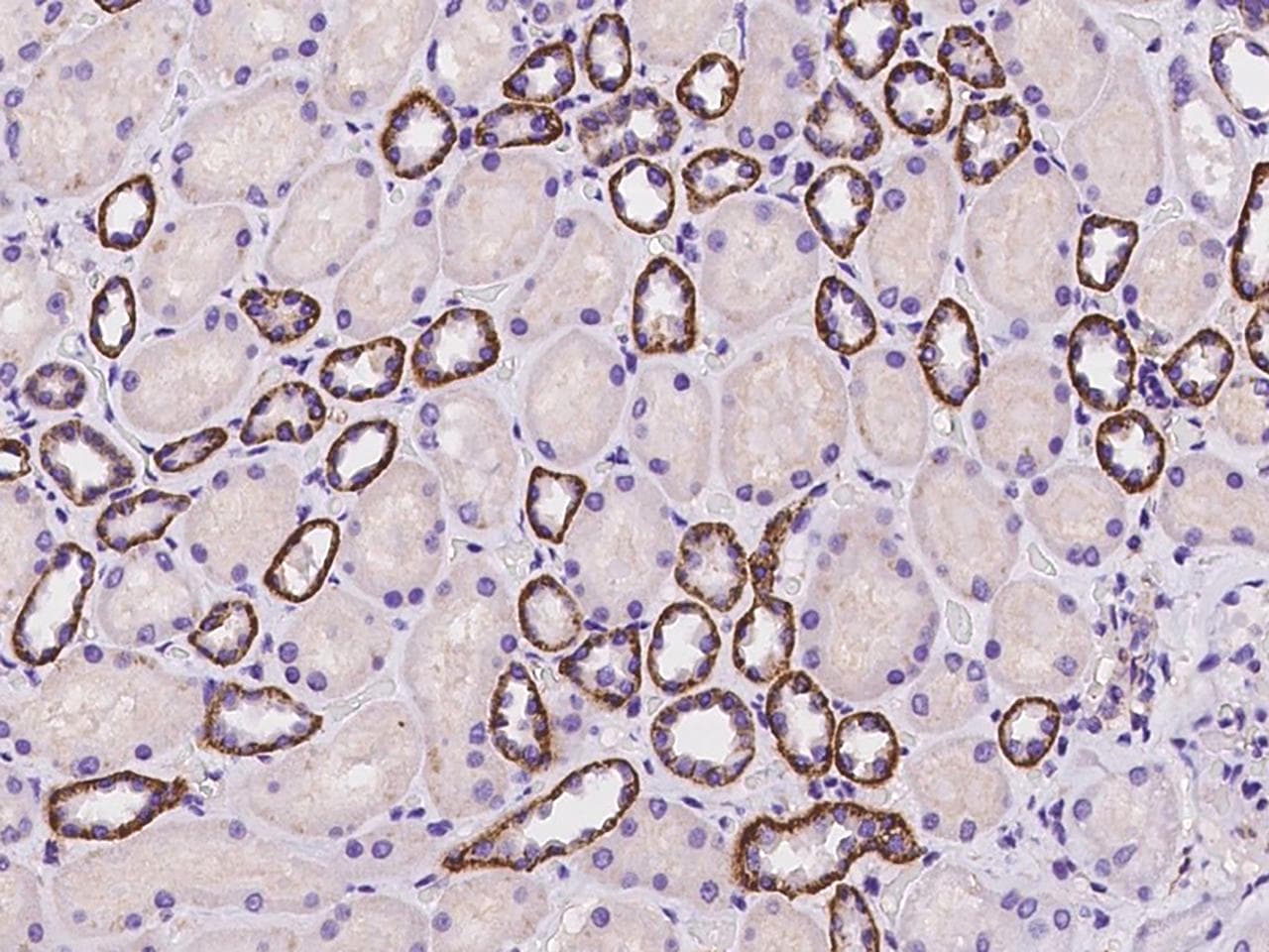 SLC9A1 / NHE1 Antibody