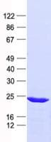 Human CBX5 / HP1 Alpha Protein (Recombinant His, N-Terminal)