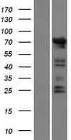 Human POTEI Protein (Over-Expression Lysate Myc-DDK (Flag))