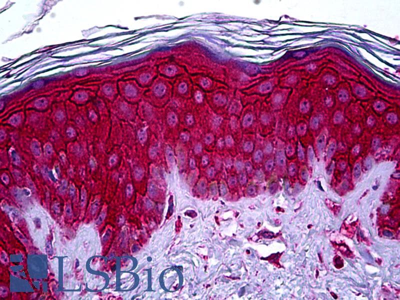IHC-plus™ Monoclonal Mouse anti-Human c-Kit / CD117 Antibody (clone X1, IHC, WB)