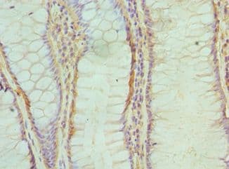 IHC-plus™ ALKBH1 / ALKB Antibody (aa110-389)