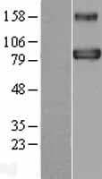 Human BACH1 Protein (Over-Expression Lysate Myc-DDK (Flag))