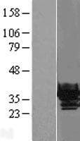CRYBB1 Protein (Over-Expression Lysate Myc-DDK (Flag))