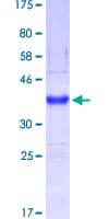 Human MUC5B Protein (Recombinant GST, N-terminus)