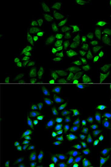 Polyclonal Rabbit anti-Human CD274 / B7-H1 / PD-L1 Antibody (IHC, IF, WB)