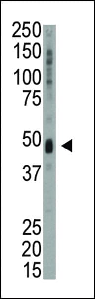Polyclonal Rabbit anti-Human UHMK1 / KIS Antibody (aa1-30, IHC, WB)