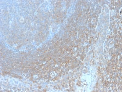 BCL10 / BCL-10 Antibody (aa122-168, clone BL10/2988R, Azide-free, Carrier-free)