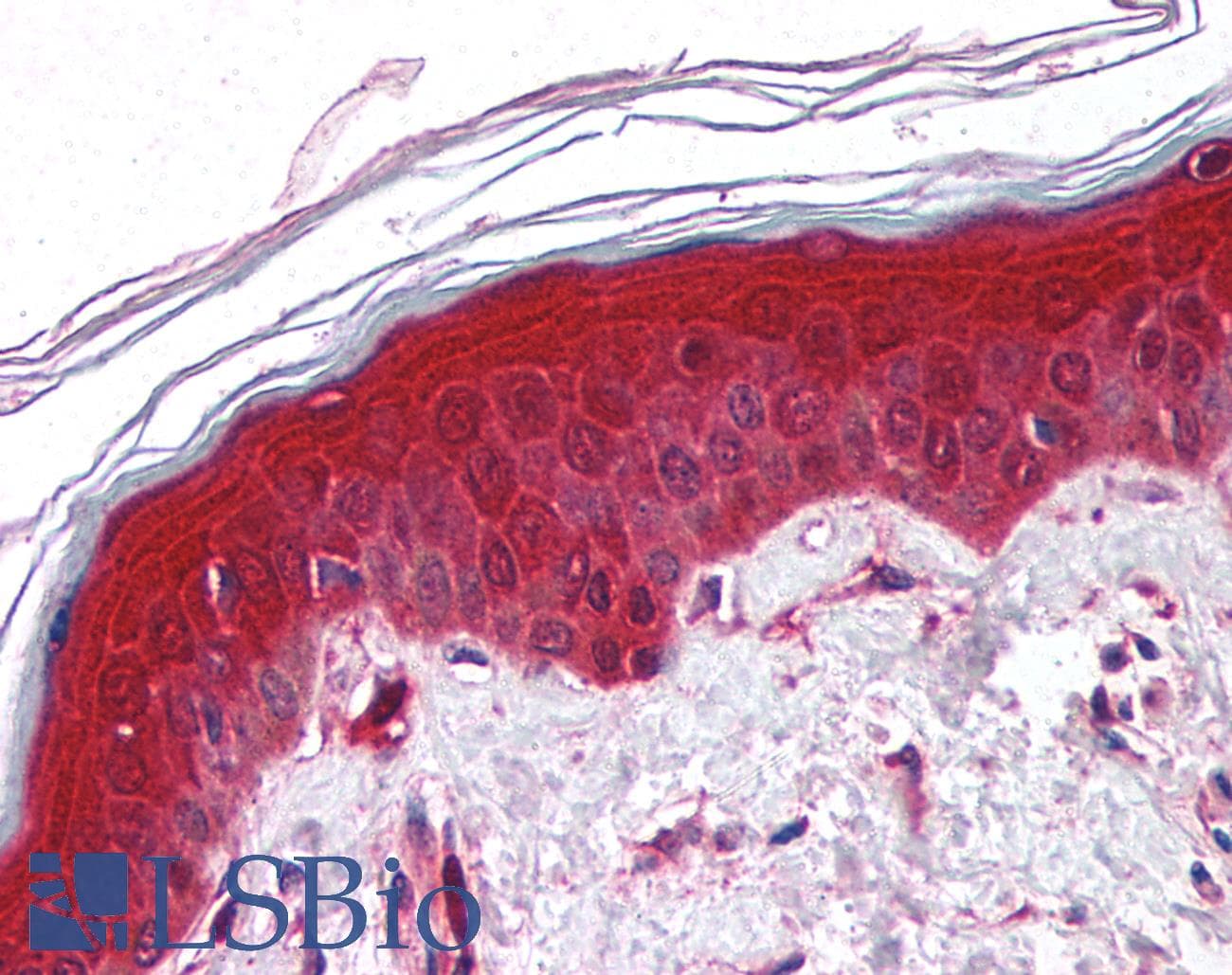 IHC-plus™ PYCARD / ASC / TMS1 Antibody