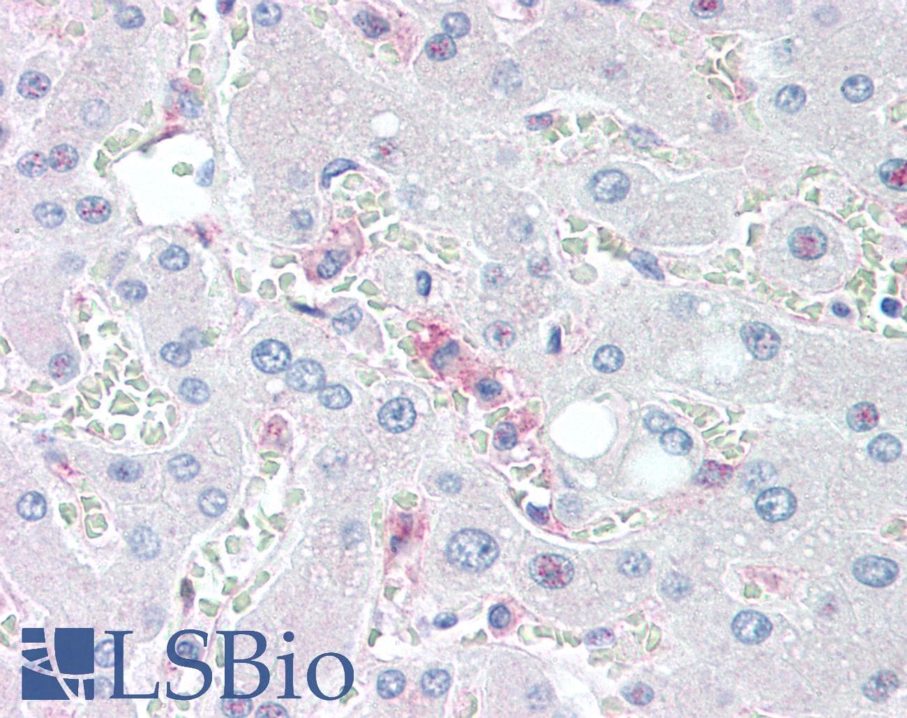 PathPlus™ CD14 Antibody