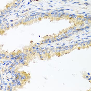 Polyclonal Rabbit anti-Human APOE / Apolipoprotein E Antibody (AP, IHC, IF)