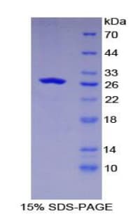 Mouse GSTK1 Protein (Recombinant His-T7)