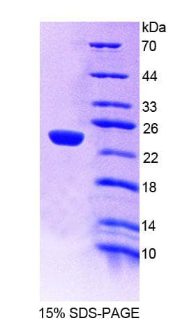 Mouse GAA / Alpha-Glucosidase, Acid Protein (Recombinant His-T7)