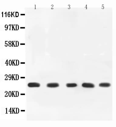 Polyclonal Rabbit anti-Rat TNF Alpha Antibody (aa89-235, WB)