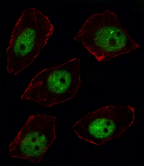 SORBS2 / ARGBP2 Antibody (aa175-204)