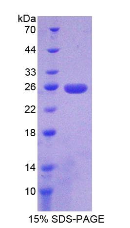 Rat UPK3A / UPK3 / Uroplakin III Protein (Recombinant His-T7)