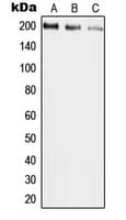 Polyclonal Rabbit anti-Human UBR2 Antibody (Internal, WB)