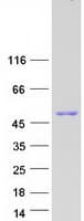Human CCT2 / CCT Beta Protein (Recombinant Myc-DDK (Flag))