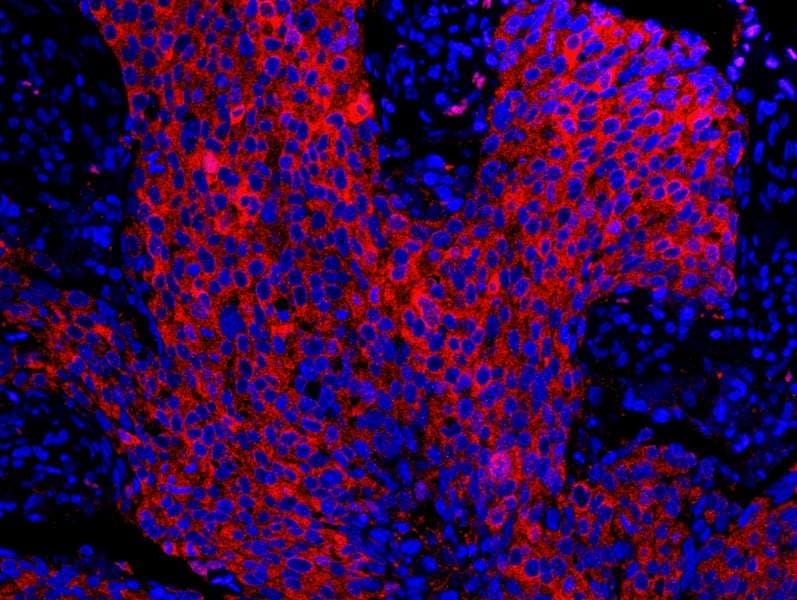 Polyclonal Rabbit anti-Human SFN / Stratifin / 14-3-3 Sigma Antibody (aa198-248, IHC, IF)