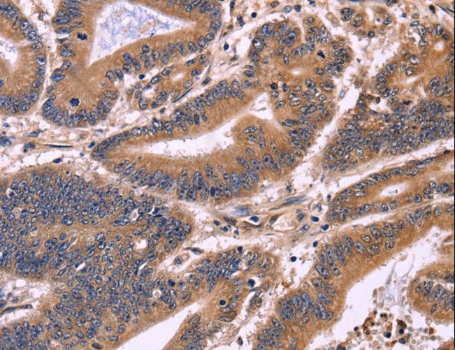 Polyclonal Rabbit anti-Human S100A13 Antibody (IHC)