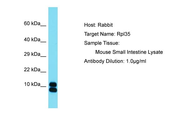 RPL35 / Ribosomal Protein L35 Antibody (aa61-110)