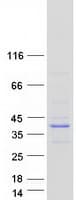 Human EVPLL Protein (Recombinant Myc-DDK (Flag))