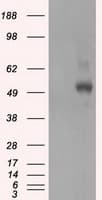 PRKAR2A Antibody (clone OTI4A3)