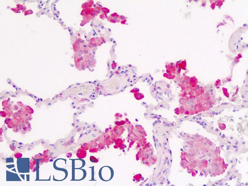 IHC-plus™ Polyclonal Rabbit anti-Human IL1R1 Antibody (aa474-503, IHC, WB)
