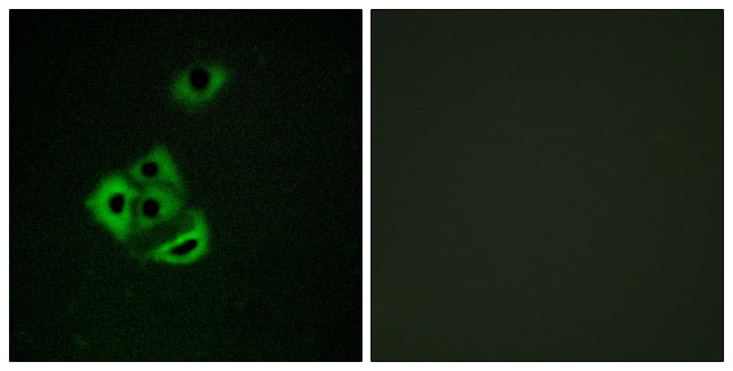 MCL1 / MCL 1 Antibody (phospho-Ser159)