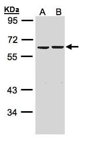 ZKSCAN3 / ZNF306 Antibody (aa1-394)